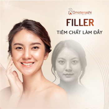 FILLER - NÂNG CƠ VÙNG MẶT