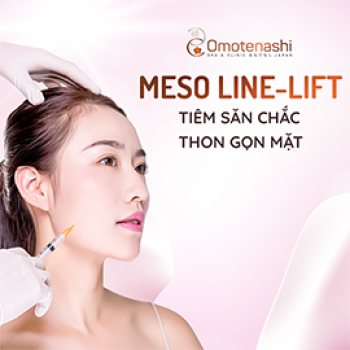 Meso line-lift - Công nghệ thẩm mỹ tiêm săn chắc thon gọn mặt