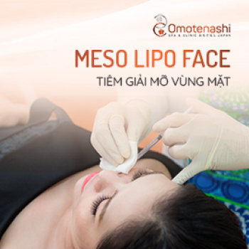 Meso Lipo Face - Tiêm giải mỡ vùng mặt