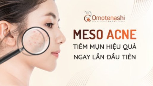 MESO ACNES- GIẢI PHÁP AN TOÀN HIỆU QUẢ CHO DA MỤN